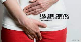 bruised cervix symptoms diagnosis