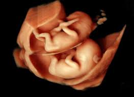Mit dem jahr 2021 ist der 3d und 4d ultraschall aus nicht medizinischen gründen für schwangere verboten werden. 3d 4d Ultraschall Praxis Fur Pranatale Diagnostik In Munchen