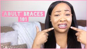 Doing this can help ensure that your treatment proceeds as. I Want Braces Is Tooth Extraction Really Necessary Dr Schulhof Know