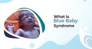 blue baby syndrome best pediatrics