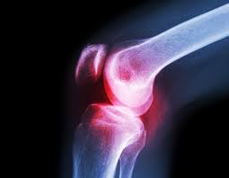 meniscus tear signs causes