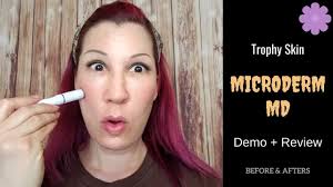 This makes it ideal for getting rid of age spots on your hands or even stretch marks on your butt. Trophy Skin Microdermmd Home Dermabrasion Kit Demo Review With Before Afters Youtube