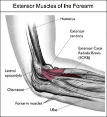 lateral epicondylitis tennis elbow