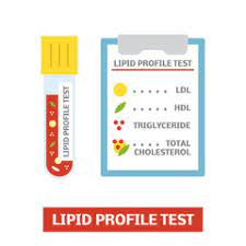 lipid profile test definition