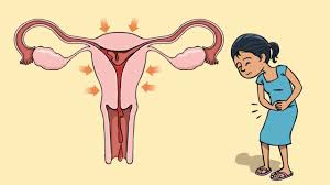 what are period crs and how to deal