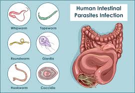 10 signs you may have a parasite