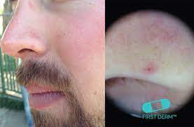 red spots on skin pictures causes