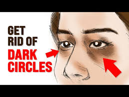 causes of dark circles under eyes
