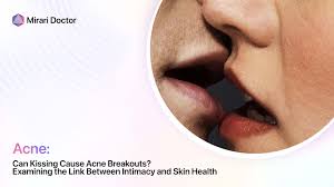 can kissing cause acne breakouts