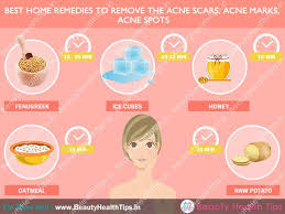 acne scars acne marks acne spots