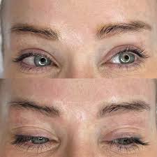 permanent makeup removal
