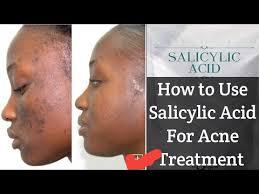 watch this befor adding salicylic acid