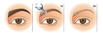 eyebrow and eyeliner tattoo removal