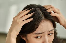 how to treat an itchy scalp according