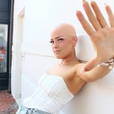 tiktok mua emmy combs talks alopecia