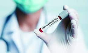 covid 19 antibody testing afc urgent