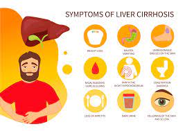 early symptoms of liver disease in