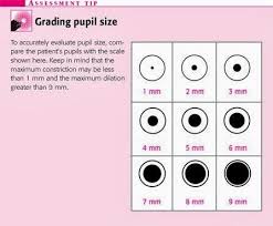 Pupil Size Chart In Neuro Success Rn Nursing School