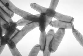 Die legionellen (legionella) stellen eine gattung stäbchenförmiger bakterien in der familie der legionellaceae dar. Legionellen Wikipedia