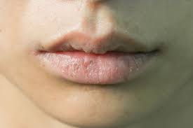 anemia lips anemia is reportedly