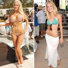 Heidi Montag Sex Tape -- Pre and Post-Op