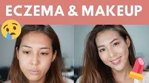 eczema journey and how to apply makeup