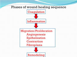 Phases Of Wound Healing Chart Thelifeisdream