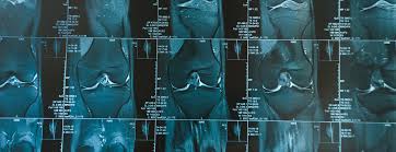 Each anatomical structure was labeled interactively. Knee Mri Scan