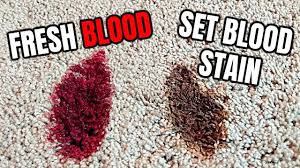 how to remove blood stains from carpet