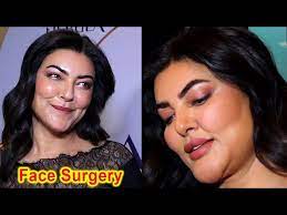 sushmita sen shocking face surgery gone
