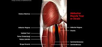 Groin pull usually discusses to slight tears of some muscle threads without a major effect on the core muscle. Adductor Muscle Tear Or Strain Thermoskin Supports And Braces For Injury And Pain Management