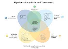 treating lipedema lipedema foundation