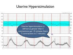 Qcom Fetal Heart Monitoring Uterine Contractions