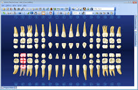 Veritable Dentrix Tooth Chart Charting A Supernumerary Tooth