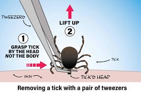 proper tick removal plus what not to