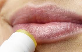 lippenherpes lippenpflegestifte gibt