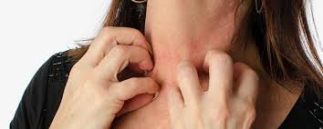 skin allergies causes symptoms