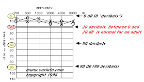 How To Understand Your Hearing Test Hearing Aid Resource