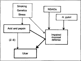 Pathogenesis Of Peptic Ulcer And Implications For Therapy Nejm