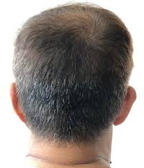 Thin hair may be hereditary or caused by damage due to pollution which does take its toll on your crowning glory. Men S Haircut For Thinning Crown Treat Hair Loss Now