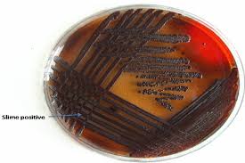 Congo red dye agar, escherichia coli, invasiveness, sereny test, bovine. Congo Red Agar Plate Test Black Colonies The Slime Producing Strains Download Scientific Diagram