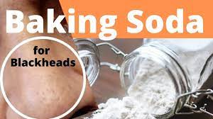 how to remove blackheads baking soda