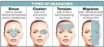 Types Of Headaches Chart Jasonkellyphoto Co