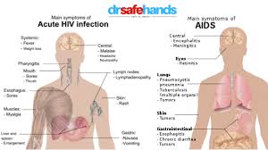 know hiv aids facts symptoms and