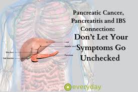 pancreatic cancer pancreais and ibs