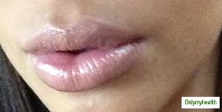 are lip changes during pregnancy real