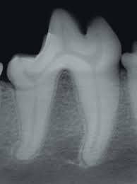 Take A Bite Out Of Dental Radiology Positioning For Picture