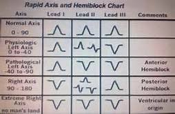 Rapid Axis And Hemi Block Chart Yahoo Image Search Results
