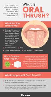 thrush symptoms causes treatment