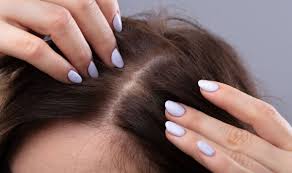 "Unlocking the Reasons for Thinning Hair and Effective Solutions from a Hair Expert"